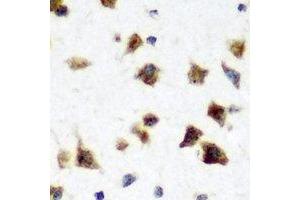 Immunohistochemical analysis of HuC staining in rat brain formalin fixed paraffin embedded tissue section. (HuC/ELAVL3 anticorps)