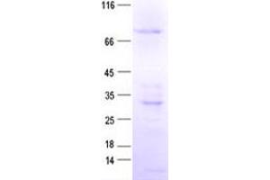 Validation with Western Blot