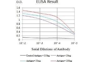 Black line: Control Antigen (100 ng),Purple line: Antigen (10 ng), Blue line: Antigen (50 ng), Red line:Antigen (100 ng)