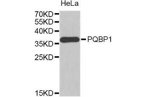 Western Blotting (WB) image for anti-Polyglutamine Binding Protein 1 (PQBP1) (AA 1-265) antibody (ABIN1682273) (PQBP1 anticorps  (AA 1-265))