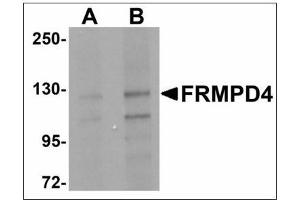 Western blot analysis of FRMPD4 in SK-N-SH cell lysate with FRMPD4 antibody at (A) 1 and (B) 2 µg/ml. (FRMPD4 anticorps)