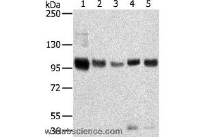 Western blot analysis of Mouse brain and human brain tissue, human prostate tissue, human fat and placenta tissue, using SORT1 Polyclonal Antibody at dilution of 1:200 (Sortilin 1 anticorps)