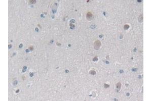 Detection of PSMb6 in Human Cerebrum Tissue using Polyclonal Antibody to Proteasome Subunit Beta Type 6 (PSMb6)