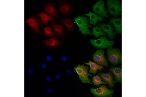 ABIN6263284 and ABIN6272925 staining Hela cells by IF/ICC. (MLYCD anticorps  (Internal Region))