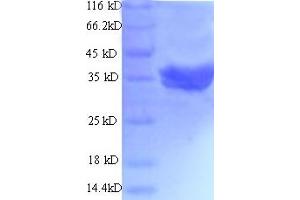 SDS-PAGE (SDS) image for Talin 2 (TLN2) (AA 88-406) protein (His-SUMO Tag) (ABIN5712011)