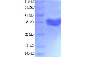 SDS-PAGE (SDS) image for Talin 2 (TLN2) (AA 88-406) protein (His-SUMO Tag) (ABIN5712011)