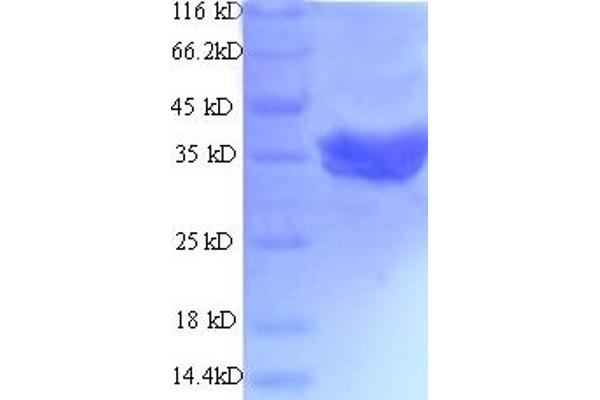 TLN2 Protein (AA 88-406) (His-SUMO Tag)