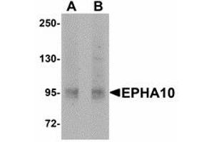Image no. 1 for anti-EPH Receptor A10 (EPHA10) (N-Term) antibody (ABIN478123) (EPH Receptor A10 anticorps  (N-Term))