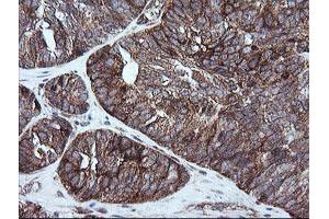 Image no. 4 for anti-RIO Kinase 2 (RIOK2) (AA 277-552) antibody (ABIN1491305) (RIOK2 anticorps  (AA 277-552))