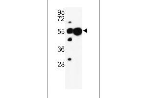 Western blot analysis of UB Antibody (N-term) (ABIN652775 and ABIN2842510) in mouse liver, cerebellum tissue lysates (35 μg/lane). (UBAP1 anticorps  (N-Term))