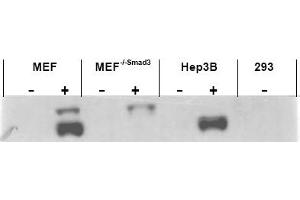 Image no. 1 for anti-SMAD, Mothers Against DPP Homolog 3 (SMAD3) (AA 417-425), (pSer423), (pSer425) antibody (ABIN401332) (SMAD3 anticorps  (pSer423, pSer425))