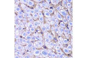 Immunohistochemistry of paraffin-embedded human liver injury using HLA-A antibody.