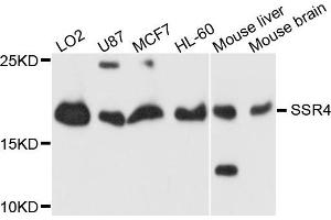 Western blot analysis of extracts of HeLa cells, using SSR4 antibody. (SSR4 anticorps)