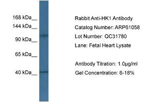 Western Blotting (WB) image for anti-Hexokinase 1 (HK1) (Middle Region) antibody (ABIN2788662) (Hexokinase 1 anticorps  (Middle Region))