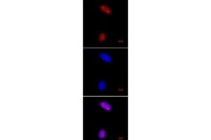Histone H3 trimethyl Lys27 antibody tested by immunofluorescence.