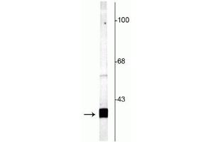 Western blot of rat cortical lysate showing specific labeling of the ~25 kDa SNAP25 protein. (SNAP25 anticorps  (C-Term))