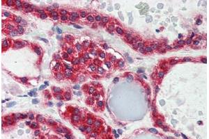 Human Thyroid (formalin-fixed, paraffin-embedded) stained with LPIN3 antibody ABIN337225 at 2. (LPIN3 anticorps  (AA 149-160))
