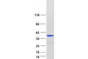Validation with Western Blot