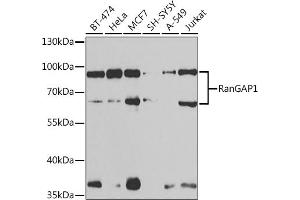 Western blot analysis of extracts of various cell lines, using RanG antibody (ABIN6128613, ABIN6146681, ABIN6146683 and ABIN6217306) at 1:1000 dilution. (RANGAP1 anticorps  (AA 398-587))