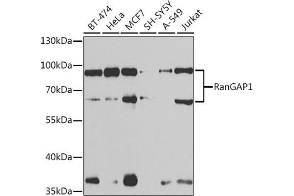 RANGAP1 anticorps  (AA 398-587)