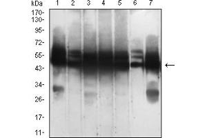 Western blot analysis using KRT18 mouse mAb against SK-Br-3 (1), HepG2 (2), T47D (3), MCF-7 (4), Hela (5), A431 (6), and HCT116 (7) cell lysate.