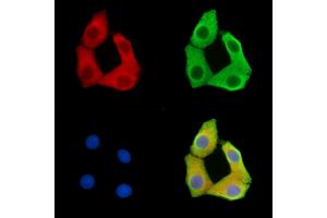 ABIN7095851 and ABIN7099913 staining Hela cells by IF/ICC. (SSX6 anticorps)
