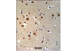 TTBK1 Antibody (N-term) (ABIN1881955 and ABIN2840093) IHC analysis in formalin fixed and paraffin embedded brain tissue followed by peroxidase conjugation of the secondary antibody and DAB staining. (TTBK1 anticorps  (N-Term))