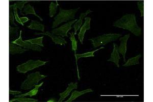Immunofluorescence of monoclonal antibody to PIM1 on HeLa cell. (PIM1 anticorps  (AA 1-313))