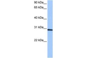 Western Blotting (WB) image for anti-Ankyrin Repeat and SOCS Box-Containing 11 (ASB11) antibody (ABIN2463472)