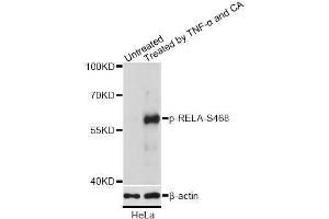 Western blot analysis of extracts of HeLa cells, using Phospho-RELA-S468 antibody (ABIN2988289) at 1/2000 dilution. (NF-kB p65 anticorps  (pSer468))