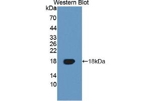 Detection of Recombinant TNFRSF19, Human using Polyclonal Antibody to Tumor Necrosis Factor Receptor Superfamily, Member 19 (TNFRSF19) (TNFRSF19 anticorps  (AA 35-160))