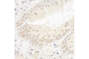 Immunohistochemistry (IHC) image for anti-DOT1-Like, Histone H3 Methyltransferase (S. Cerevisiae) (DOT1L) (AA 1000-1050) antibody (ABIN7448534) (DOT1L anticorps  (AA 1000-1050))