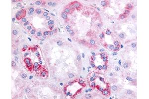 Anti-GPR91 antibody IHC of human kidney, renal tubular epithelium in cortex. (SUCNR1 anticorps  (Cytoplasmic Domain))