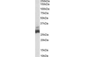 ABIN2559853 (0. (SDHB anticorps  (C-Term))
