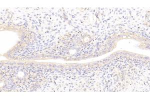Detection of LAMb2 in Rat Uterus Tissue using Polyclonal Antibody to Laminin Beta 2 (LAMb2) (LAMB2 anticorps  (AA 939-1129))