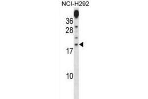 Western Blotting (WB) image for anti-Proline Rich 15 (PRR15) antibody (ABIN2998394) (Proline Rich 15 anticorps)