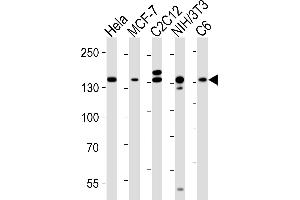 Western blot analysis of lysates from Hela, MCF-7, mouse C2C12, mouse NIH/3T3, rat C6 cell line (from left to right), using RPTOR Antibody (ABIN6243898 and ABIN6577082).
