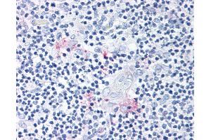 Anti-ROR Gamma antibody IHC of human thymus.
