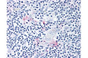 Anti-ROR Gamma antibody IHC of human thymus. (RORC anticorps  (Modulating Domain))