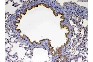 IHC testing of FFPE rat lung tissue with Factor D antibody at 1ug/ml. (Adipsin anticorps  (AA 26-263))