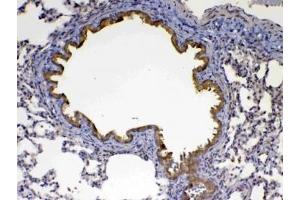 IHC testing of FFPE rat lung tissue with Factor D antibody at 1ug/ml.