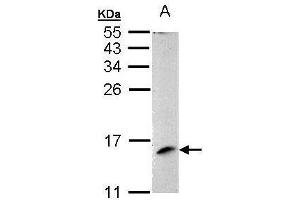 WB Image Sample (30 ug of whole cell lysate) A: 293T 15% SDS PAGE antibody diluted at 1:1000 (MAPKSP1 anticorps)
