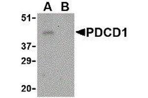 Western Blotting (WB) image for anti-Programmed Cell Death 1 (PDCD1) (Center) antibody (ABIN2479656)