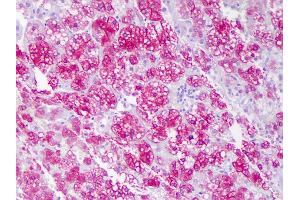 Anti-ACAT1 antibody IHC of human adrenal cortex. (ACAT1 anticorps  (N-Term))