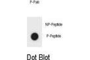 Dot blot analysis of KIT Antibody (Phospho ) Phospho-specific Pab (ABIN1881482 and ABIN2850466) on nitrocellulose membrane.