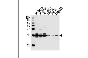 Western blot analysis of lysates from mouse heart, mouse liver, rat heart tissue, HL-60, A431, HepG2 cell line (from left to right), using (DANRE) sdhb Antibody Azb18722a. (SDHB anticorps  (AA 147-182))