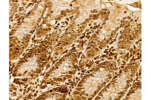 ABIN7094279 and ABIN7098326 at 1/100 staining Rat colon tissue by IHC-P.