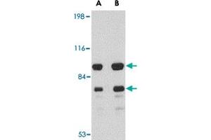 Western blot analysis of DLGAP1 in rat brain tissue lysate with DLGAP1 polyclonal antibody  at (A) 0. (DLGAP1 anticorps  (Internal Region))