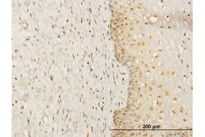 Immunoperoxidase of monoclonal antibody to FKBP4 on formalin-fixed paraffin-embedded human uterine cervix.