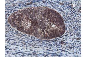 Image no. 5 for anti-Epsin 2 (EPN2) antibody (ABIN1498049)